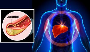 Cholesterol and the Liver