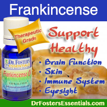 Therapeutic Grade Frankincense Oil