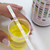 urinalysis