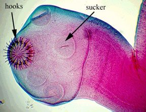 Head of a tapeworm