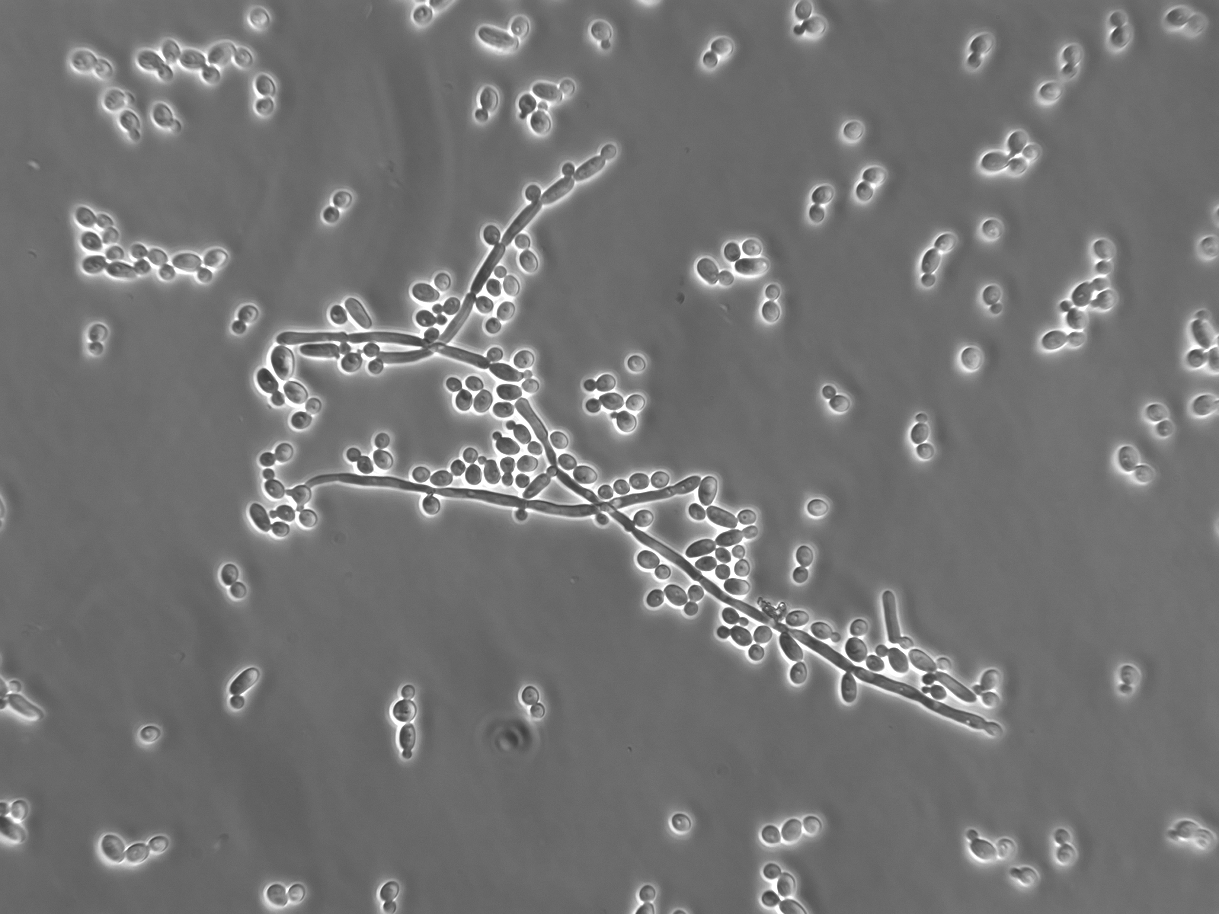 Anti-Candida Program