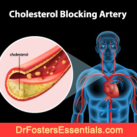 Healthy Cholesterol Formula - it's back!