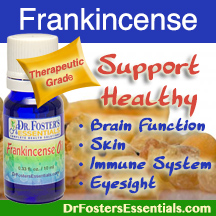 Frankincense Essential Oil