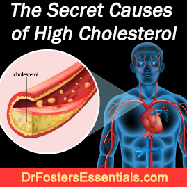 Cholesterol Busters Program